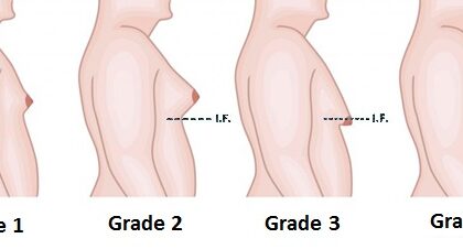 Breast Augmentation in Islamabad