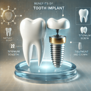 Tooth Implants Are the Best Solution for Missing Teeth