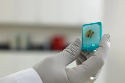 FFPE Tissue Samples
