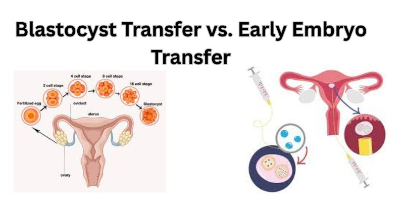 Blastocyst Transfer vs. Early Embryo Transfer Making the Right Choice