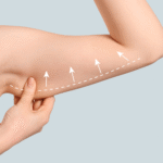 J Plasma Lipo – NYC’s Ultimate Skin Tightening Boost