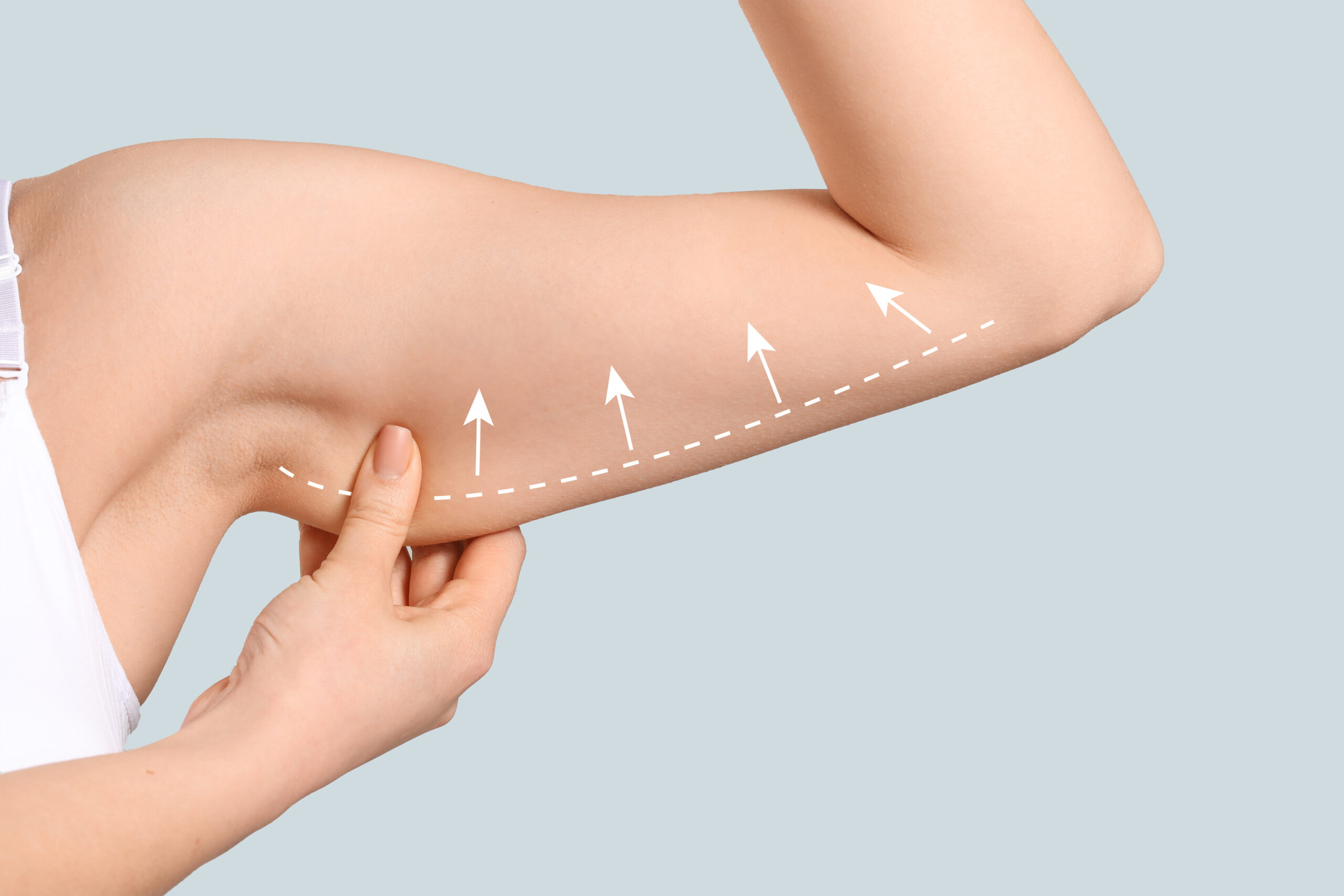 J Plasma Lipo – NYC’s Ultimate Skin Tightening Boost