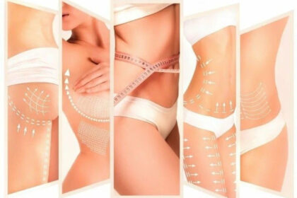 Venus Legacy in Riyadh | Tighten Skin & Sculpt Your Body