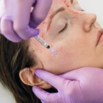 Vampire Facial in Dubai