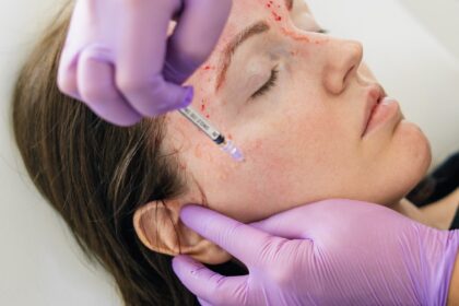 Vampire Facial in Dubai
