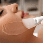 Chemical Peels Cost in Dubai