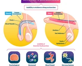Erectile dysfunction (ED) affects millions of men worldwide, interfering with intimate relationships and self-confidence.