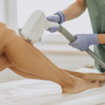Laser Treatment Costs in Dubai