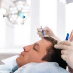 زراعة الشعر في الرياض