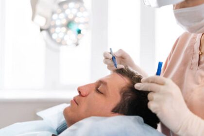 زراعة الشعر في الرياض