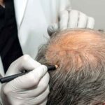 Hair Specialist Doctor In Dubai,Hair Specialist Doctor,Best Hair Specialist Doctor In Dubai