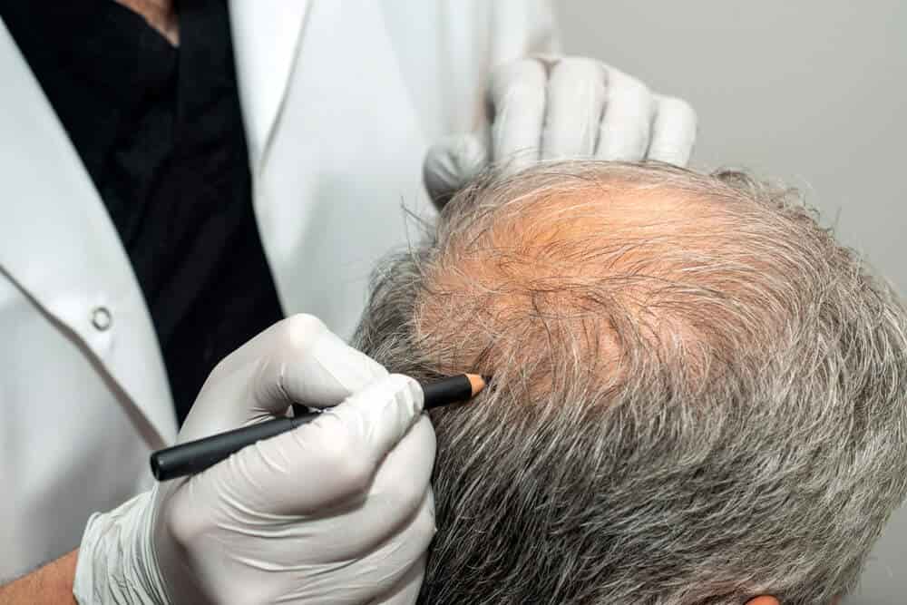 Hair Specialist Doctor In Dubai,Hair Specialist Doctor,Best Hair Specialist Doctor In Dubai